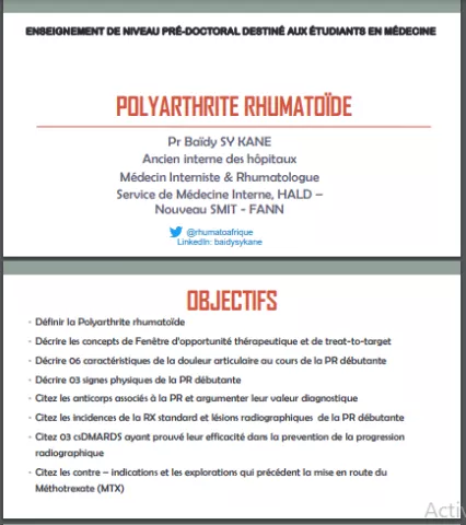 Polyarthrite rhumatoïde
