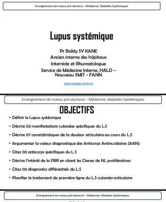 Lupus systémique