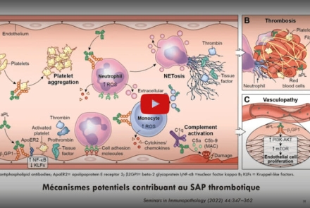 Pr AGBODANDE Kouessi Anthelme : Le syndrome des antiphospholipides - Diagnostic et Classification