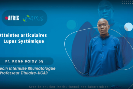Atteintes articulaires du Lupus systémique, Pr Kane Baïdy SY