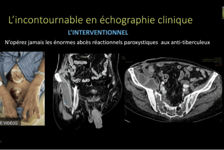 Dr Ahmed Ould Hennia : Indications de l’Échographie clinique dans les Maladies Systémiques